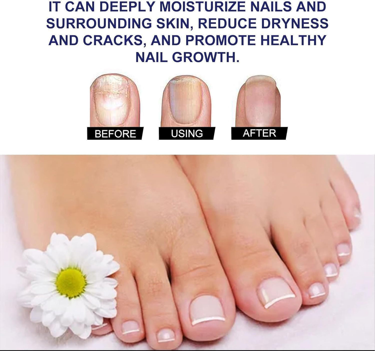 Ginger Nail Revive Nail Care Set