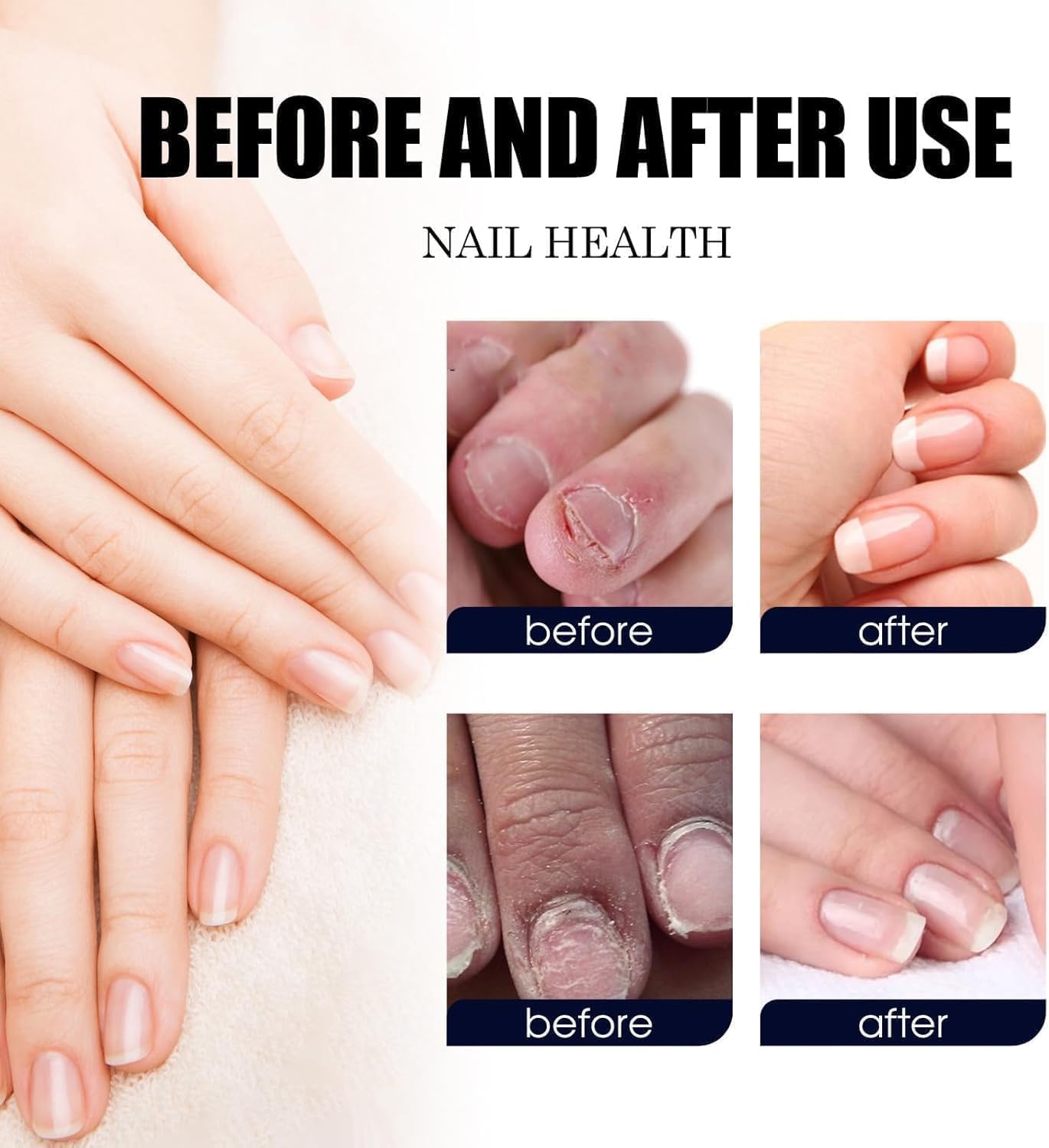 Ginger Nail Revive Nail Care Set