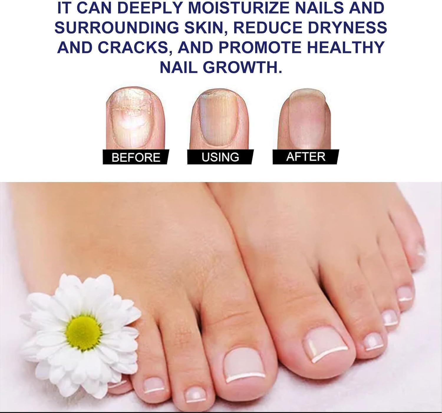 Ginger Nail Revive Nail Care Set
