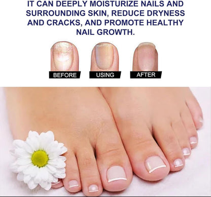 Ginger Nail Revive Nail Care Set