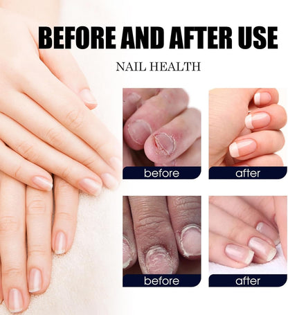Ginger Nail Revive Nail Care Set